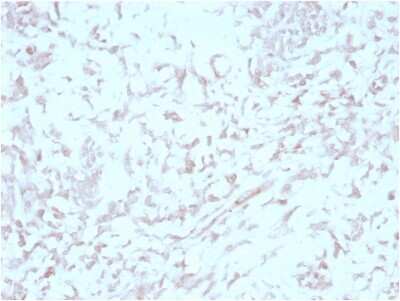 Immunohistochemistry-Paraffin: MIG2/Kindlin-2 Antibody (3A3) [NBP3-13846] - Formalin-fixed, paraffin-embedded human liver stained with MIG2/Kindlin-2 antibody (3A3).