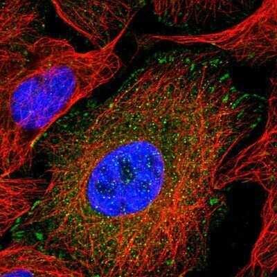 Immunocytochemistry/Immunofluorescence: MIG2/Kindlin-2 Antibody [NBP1-87884] - Staining of human cell line U-2 OS shows positivity in focal adhesions. Antibody staining is shown in green. 