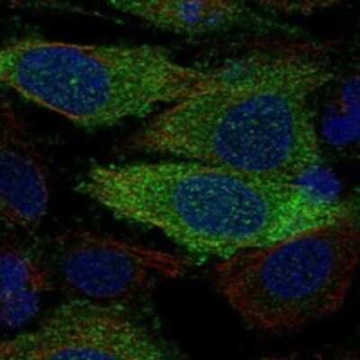 Immunocytochemistry/Immunofluorescence: MIG2/Kindlin-2 Antibody [NBP3-17740] - Staining of human cell line SiHa shows localization to cytosol & focal adhesion sites.