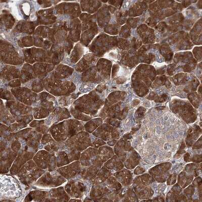 Immunohistochemistry-Paraffin: MIG2/Kindlin-2 Antibody [NBP1-87884] - Staining of human pancreas shows strong cytoplasmic positivity in exocrine glandular cells.