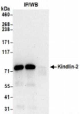 <b>Biological Strategies Validation. </b>Immunoprecipitation: MIG2/Kindlin-2 Antibody [NBP2-36541] - Samples: Whole cell lysate (0.5 or 1.0 mg per IP reaction; 20% of IP loaded) from 293T cells prepared using NETN lysis buffer. For blotting immunoprecipitated Kindlin-2, it was used at 0.4 ug/ml. Detection: Chemiluminescence with an exposure time of 30 seconds.