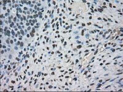 Immunohistochemistry: MIG2/Kindlin-2 Antibody (OTI9E4) - Azide and BSA Free [NBP2-72687] - Staining of paraffin-embedded Human Ovary tissue using anti-Kindlin-2 mouse monoclonal antibody.