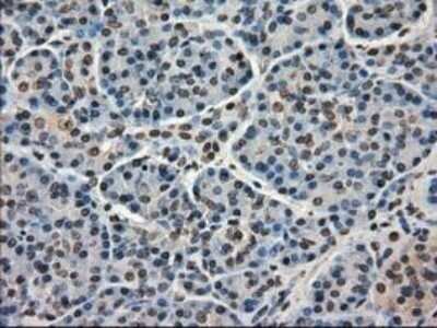 Immunohistochemistry: MIG2/Kindlin-2 Antibody (OTI9E4) - Azide and BSA Free [NBP2-72687] - Staining of paraffin-embedded Human pancreas tissue using anti-Kindlin-2 mouse monoclonal antibody.