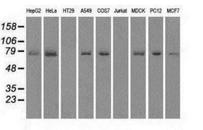 Western Blot: MIG2/Kindlin-2 Antibody (OTI9E4) - Azide and BSA Free [NBP2-72687] - Analysis of extracts (35ug) from 9 different cell lines by using anti-Kindlin-2 monoclonal antibody.