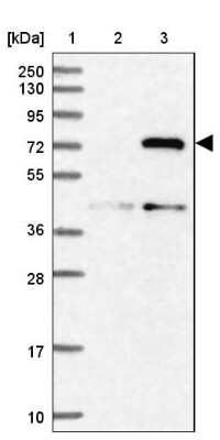 Western Blot: MIG2/Kindlin-2 Antibody [NBP1-87884] - Lane 1: Marker  [kDa] 250, 130, 95, 72, 55, 36, 28, 17, 10.  Lane 2: Human cell line RT-4.  Lane 3: Human cell line U-251MG sp