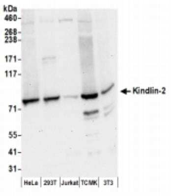 Western Blot: MIG2/Kindlin-2 Antibody [NBP2-36541] - Samples: Whole cell lysate (50 ug) from HeLa, 293T, Jurkat,  mouse TCMK-1, and mouse NIH3T3 cells prepared using NETN lysis buffer. Antibodies: Affinity purified rabbit anti-Kindlin-2 antibody used for WB at 0.1 ug/ml. Detection: Chemiluminescence with an exposure time of 30 seconds.