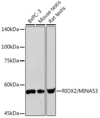 Western Blot: MINA Antibody (4E6G6) [NBP3-15931] - Western blot analysis of extracts of various cell lines, using RIOX2/MINA Rabbit mAb (NBP3-15931) at 1:1000 dilution. Secondary antibody: HRP Goat Anti-Rabbit IgG (H+L) at 1:10000 dilution. Lysates/proteins: 25ug per lane. Blocking buffer: 3% nonfat dry milk in TBST. Detection: ECL Basic Kit. Exposure time: 90s.
