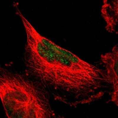 Immunocytochemistry/Immunofluorescence: MINA Antibody [NBP1-89862] - Immunofluorescent staining of human cell line U-251 MG shows localization to nucleus.