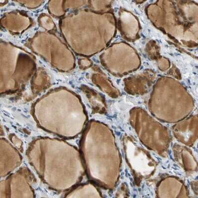 Immunohistochemistry-Paraffin: MINA Antibody [NBP1-89862] - Staining of human thyroid gland shows nuclear and cytoplasmic positivity in glandular cells.