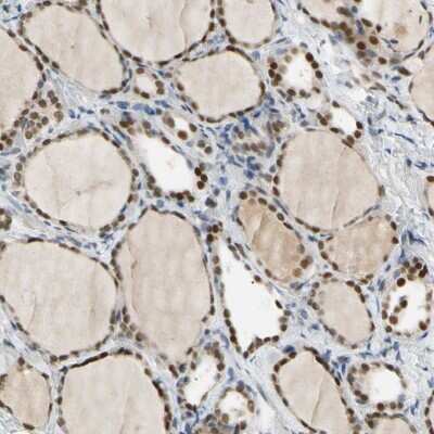 Immunohistochemistry-Paraffin: MINA Antibody [NBP1-89863] - Staining of human thyroid gland shows nuclear positivity in glandular cells.