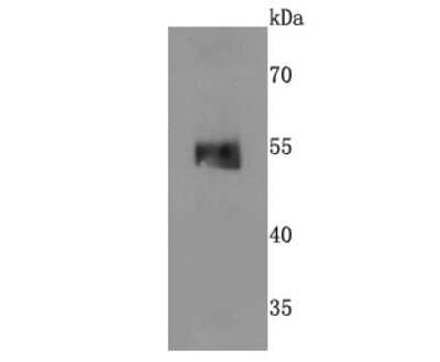 Western Blot: MINA Antibody (JA11-63) [NBP2-66950] - Analysis of MINA53 on PC-12 cells lysates using anti-MINA53 antibody at 1/500 dilution.