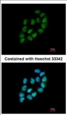 Immunocytochemistry/Immunofluorescence: MINA53 Antibody [NBP2-17293] - Immunofluorescence analysis of paraformaldehyde-fixed A431, using antibody at 1:200 dilution.
