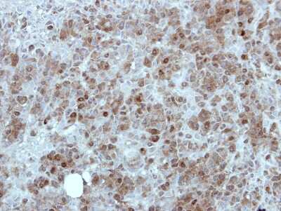 Immunohistochemistry-Paraffin: MINA53 Antibody [NBP2-17293] - Immunohistochemical analysis of paraffin-embedded HBL435 xenograft, using antibody at 1:100 dilution.