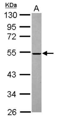 Western Blot: MINA53 Antibody [NBP2-17292] - Sample (30 ug of whole cell lysate) A: Jurkat 10% SDS PAGE gel, diluted at 1:2000.