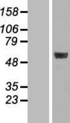 Western Blot: MINA53 Overexpression Lysate (Adult Normal) [NBL1-13111] Left-Empty vector transfected control cell lysate (HEK293 cell lysate); Right -Over-expression Lysate for MINA53.
