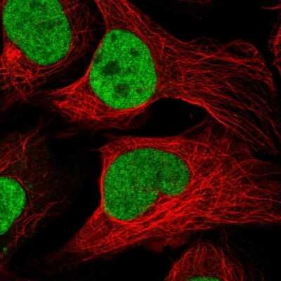 Immunocytochemistry/Immunofluorescence: MINDY2 Antibody [NBP2-14724] - Staining of human cell line U-2 OS shows localization to nucleoplasm. Antibody staining is shown in green.