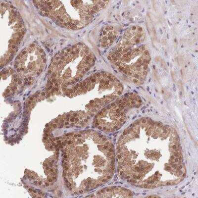 Immunohistochemistry-Paraffin: MINDY2 Antibody [NBP2-14724] - Immunohistochemical staining of human prostate shows  strong nuclear and cytoplasmic positivity in glandular cells.