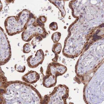 Immunohistochemistry-Paraffin: MINDY2 Antibody [NBP2-14724] - Immunohistochemical staining of human placenta shows strong nuclear and cytoplasmic positivity in trophoblastic cells.