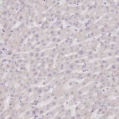 Immunohistochemistry-Paraffin: MINDY2 Antibody [NBP2-14724] - Staining of human liver shows no positivity in hepatocytes as expected.