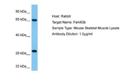 Western Blot: MINDY2 Antibody [NBP2-85287] - Host: Rabbit. Target Name: FAM63B. Sample Tissue: Mouse Skeletal Muscle lysates. Antibody Dilution: 1ug/ml