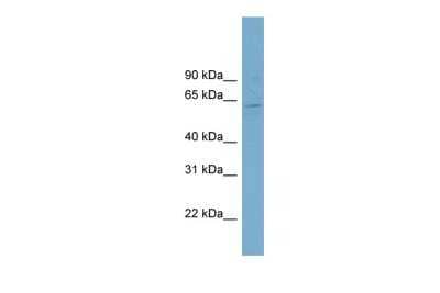MINDY4B/FAM188B2 Antibody [NBP3-18693] - WB Suggested MINDY4B/FAM188B2 antibody Titration: 0.2-1 ug/mlELISA Titer: 1:312500Positive Control: OVCAR-3 cell lysate