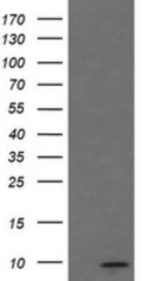 Western Blot: MINOS1 Antibody (OTI4H7) - Azide and BSA Free [NBP2-72692] - Analysis of HEK293T cells were transfected with the pCMV6-ENTRY control (Left lane) or pCMV6-ENTRY MINOS1.