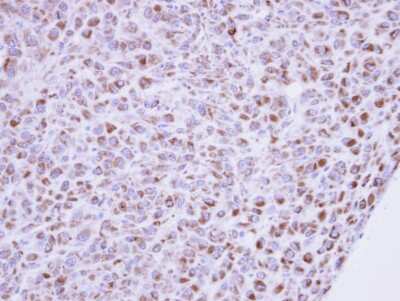 Immunohistochemistry-Paraffin: MINPP1 Antibody [NBP1-32872] - Paraffin-embedded U87 xenograft, using antibody at 1:100 dilution.