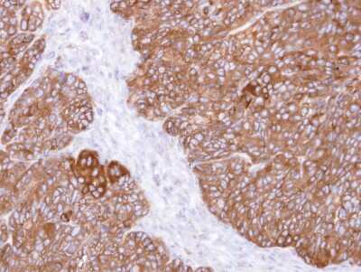 Immunohistochemistry-Paraffin: MINPP1 Antibody [NBP1-33491] - Paraffin-embedded DLD-1 xenograft, using antibody at 1:500 dilution.