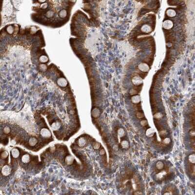 Immunohistochemistry-Paraffin MINPP1 Antibody - BSA Free