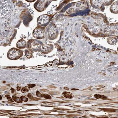 Immunohistochemistry-Paraffin: MINPP1 Antibody [NBP1-82644] - Staining of human placenta shows strong cytoplasmic positivity in trophoblastic and decidual cells.