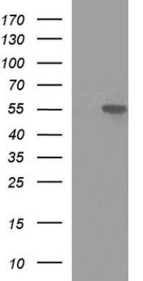 Western Blot: MINPP1 Antibody (OTI1B2) - Azide and BSA Free [NBP2-72693] - Analysis of HEK293T cells were transfected with the pCMV6-ENTRY control (Left lane) or pCMV6-ENTRY MINPP1.
