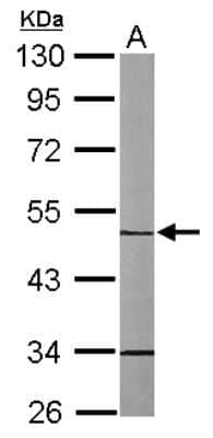Western Blot MINPP1 Antibody - BSA Free