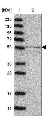 Western Blot MINPP1 Antibody - BSA Free