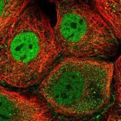 Immunocytochemistry/ Immunofluorescence MIOS Antibody - BSA Free
