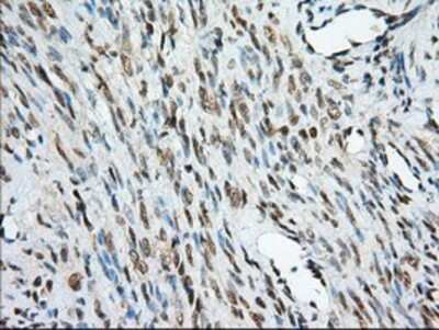 Immunohistochemistry-Paraffin: MIOX Antibody (4G7) [NBP2-02771] - Staining of paraffin-embedded Human endometrium tissue using anti-MIOX mouse monoclonal antibody.