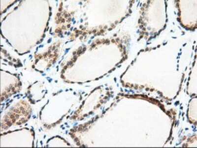 Immunohistochemistry-Paraffin: MIOX Antibody (4G7) [NBP2-02771] - Staining of paraffin-embedded Human thyroid tissue using anti-MIOX mouse monoclonal antibody.
