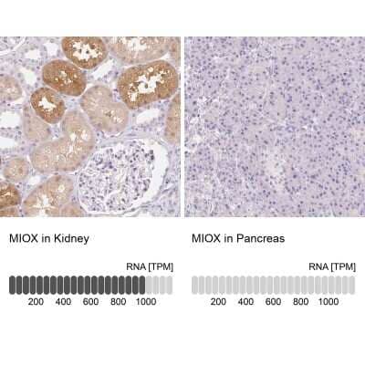 <b>Orthogonal Strategies Validation. </b>Immunohistochemistry-Paraffin: MIOX Antibody [NBP2-31975] - Staining in human kidney and pancreas tissues using anti-MIOX antibody. Corresponding MIOX RNA-seq data are presented for the same tissues.