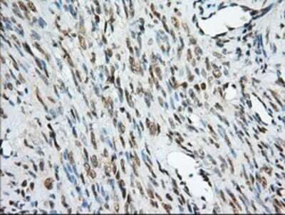 Immunohistochemistry: MIOX Antibody (OTI4G7) - Azide and BSA Free [NBP2-72697] - Staining of paraffin-embedded Human endometrium tissue using anti-MIOX mouse monoclonal antibody.