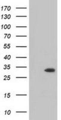Western Blot: MIOX Antibody (OTI4G7) - Azide and BSA Free [NBP2-72697] - HEK293T cells were transfected with the pCMV6-ENTRY control (Left lane) or pCMV6-ENTRY MIOX (Right lane) cDNA for 48 hrs and lysed. Equivalent amounts of cell lysates (5 ug per lane) were separated by SDS-PAGE and immunoblotted with anti-MIOX.