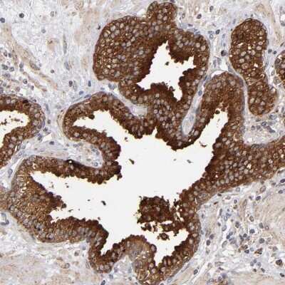 <b>Orthogonal Strategies Validation. </b>Immunohistochemistry-Paraffin: MIPOL1 Antibody [NBP1-86161] - Staining of human prostate shows high expression.