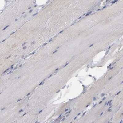 Immunohistochemistry-Paraffin: MIPOL1 Antibody [NBP1-86161] - Staining of human skeletal muscle shows low expression as expected.