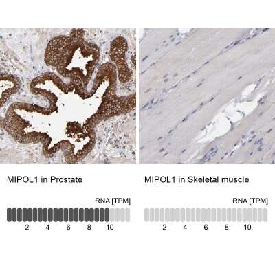 Immunohistochemistry-Paraffin: MIPOL1 Antibody [NBP1-86161] - Staining in human prostate and skeletal muscle tissues using anti-MIPOL1 antibody. Corresponding MIPOL1 RNA-seq data are presented for the same tissues.