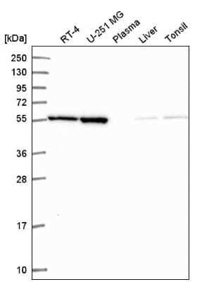Western Blot: MIPOL1 Antibody [NBP2-55615] - Western blot analysis in human cell line RT-4, human cell line U-251 MG, human plasma, human liver tissue and human tonsil tissue.