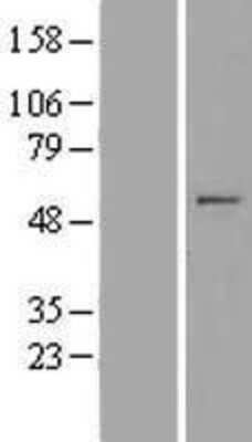 Western Blot: MIPOL1 Overexpression Lysate (Adult Normal) [NBP2-05636] Left-Empty vector transfected control cell lysate (HEK293 cell lysate); Right -Over-expression Lysate for MIPOL1.