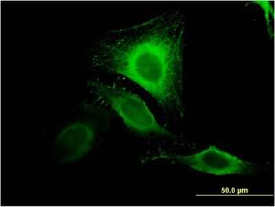 Immunocytochemistry/Immunofluorescence: MIR16 Antibody (2H6) [H00051573-M04] - Analysis of monoclonal antibody to GDE1 on HeLa cell. Antibody concentration 10 ug/ml