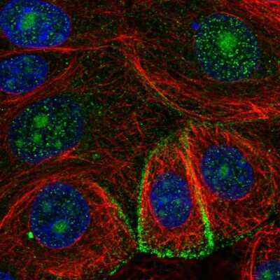 Immunocytochemistry/Immunofluorescence: MIR16 Antibody [NBP2-57760] - Staining of human cell line MCF7 shows localization to nucleoli & vesicles.