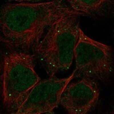 Immunocytochemistry/ Immunofluorescence MIR16 Antibody