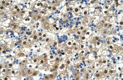 Immunohistochemistry: MIR16 Antibody [NBP1-69654] - Staining of human Liver.