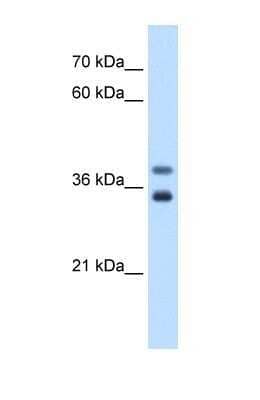 Western Blot: MIR16 Antibody [NBP1-69654] - This Anti-GDE1 antibody was used in Western Blot of Jurkat tissue lysate at a concentration of 0.5ug/ml.