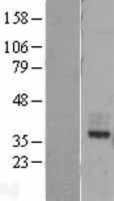 Western Blot: MIR16 Overexpression Lysate (Adult Normal) [NBL1-11023] Left-Empty vector transfected control cell lysate (HEK293 cell lysate); Right -Over-expression Lysate for MIR16.